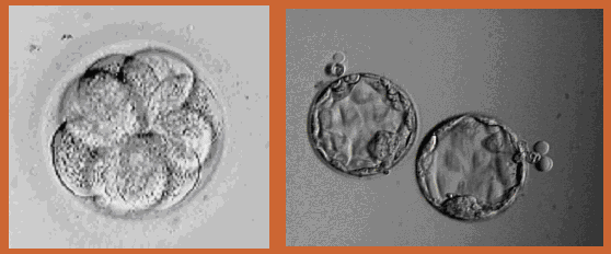 embryo transfer